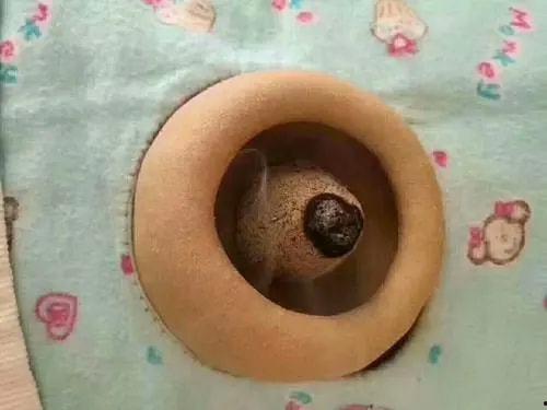 脐灸操作视频,轻松掌握养生新技能